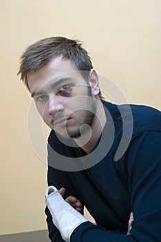 Young man with bruise