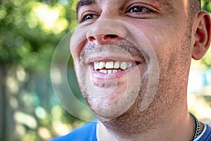 Young man with a chipped tooth