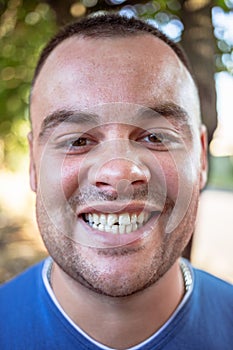 Young man with a chipped tooth