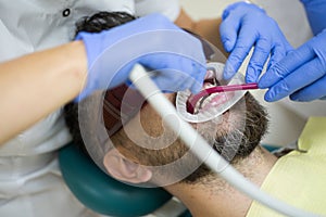 Young man choosing color of teeth at dentist, close-up. Female dentist checking patient teeth with mirror in modern