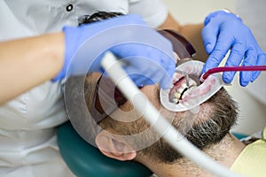 Young man choosing color of teeth at dentist. Dentist examining patient`s teeth in clinic. Smiling young man after visit