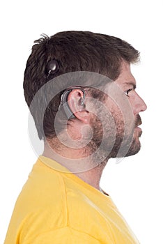 Young man with cochlear implant