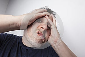 Young man with cold sore