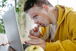 Young man with down syndrome learning online at home, using laptop. Telehealth consultation with doctor.