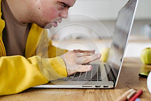 Young man with down syndrome learning online at home, using laptop. Telehealth consultation with doctor.