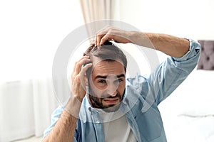 Young man with hair loss problem