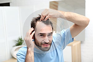 Young man with hair loss problem