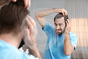 Young man with hair loss problem in front of mirror