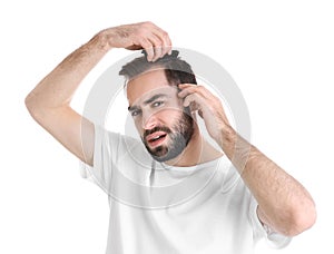 Young man with hair loss problem