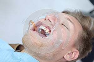A young man installs braces in a dental clinic. Alignment of the dentition or bite.A dental expander.The concept of photo