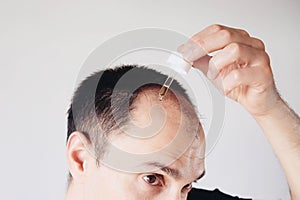 Young man looking at mirror worry about balding