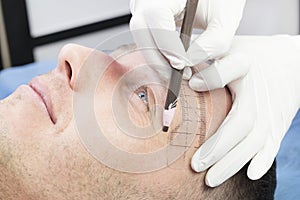 Young man microblading procedure to improve the condition of a mans eyebrows