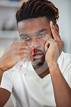 young man with nosebleed or epistaxis photo