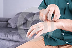 Young man scratching his hand while sitting on sofa at home. Healthcare medical or daily life concept