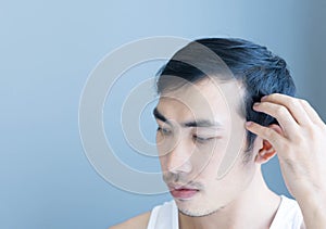 Young man serious hair loss problem for health care medical and shampoo product concept, selective focus