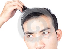 Young man serious hair loss problem for health care medical and shampoo product concept, selective focus