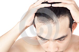 Young man serious hair loss problem for health care medical and shampoo product concept, selective focus