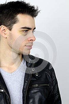 Young man with shiner photo