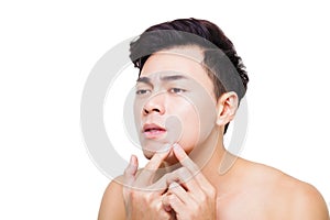 young man Squeezing pimple