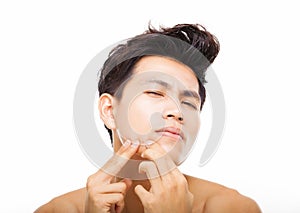 young man Squeezing pimple