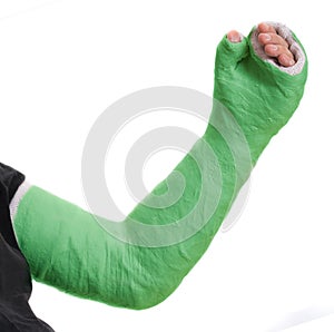Young man wearing a green long arm plaster fiberglass cast