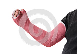 Young man wearing a red long arm plaster fiberglass cast