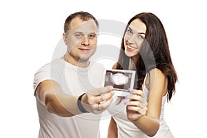 Young man and woman show the result of ultrasound. Early gestational age. Love and happiness waiting