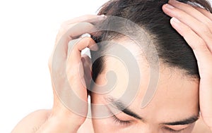 Young man worry hair loss problem for health care shampoo and be