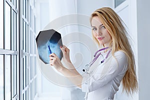 Young medical doctor woman pointing on x-ray