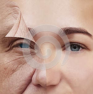 Young and old face before and after concept