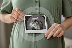 Young pregnant female holding sonogram picture of her unborn baby
