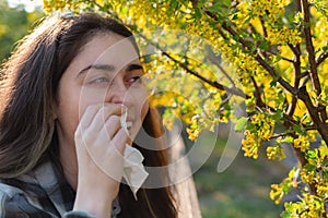 A young pretty woman is suffering from allergies. Red eyes and running snot. The concept of seasonal allergies and colds. Close up