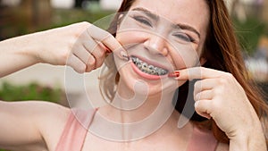 Young red-haired woman with braces on her teeth point to a smile outdoors in summer