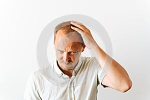 Young sad bald man with depression at hair loss problems looking angry and frustrated and holding his head. Before hair