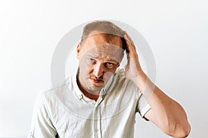 Young sad bald man with depression at hair loss problems looking angry and frustrated and holding his head. Before hair