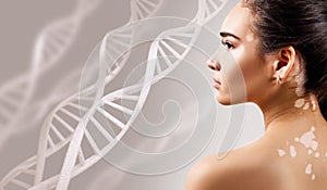 Young sensual woman with vitiligo disease in DNA chains. photo