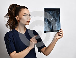 Young serious brunette woman doctor gynecologist in blue medical gown is looking and pointing at X-ray of pelvis