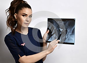 Young smiling brunette woman doctor gynecologist in blue dress standing and showing ultrasound shot to camera