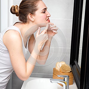Young woman with acne squeezing her spots with bathroom mirror