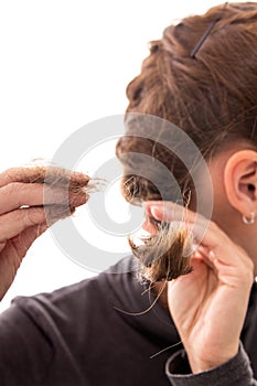 Young woman with alopecia, isolated on white, concept hair loss