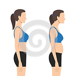 Young woman with bad posture. Spine. Profile