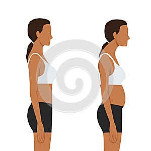 Young woman with bad posture. Spine. Profile