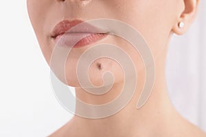 Young woman with birthmark in clinic, closeup. Visiting dermatologist