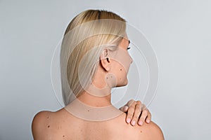 Young woman with birthmarks on light grey background, back view