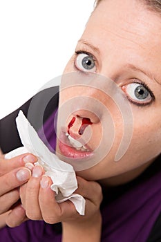 Young woman with bleeding nose isolated on white