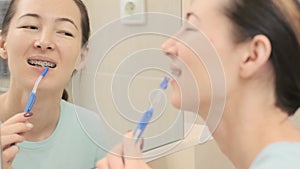 Young woman with braces cleans her teeth with a special dental brush, before mirror.