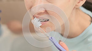 Young woman with braces on her teeth brushing her teeth with a toothbrush, close-up, before mirror.