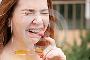 Young woman with braces on her teeth smiles and shows her tongue outdoors.
