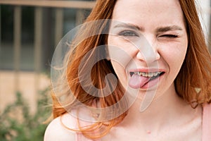 Young woman with braces on her teeth smiles and shows her tongue outdoors.