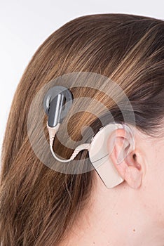 Young woman with cochlear implant photo